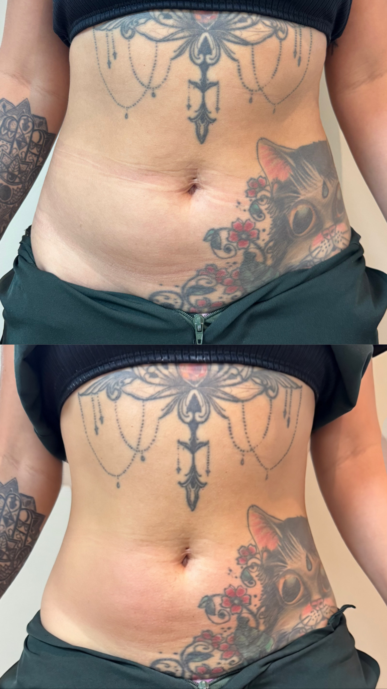 Resultado antes e depois — acompanhamento de protocolo